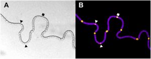 Células que cuentan: explorando la interacción entre genes, física y adaptación en la cianobacteria Anabaena
