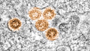 Sección de una célula infectada por SARS-CoV2 (partículas virales en naranja) 